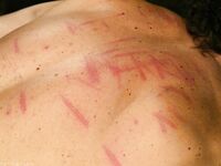 Men In Pain starring Nick Jacobs, Penny Flame XXX Gallery
